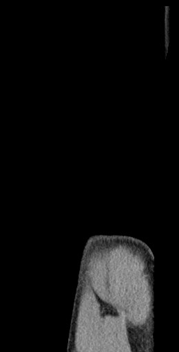 Schwarze und weiße MRI-Aufnahme eines Knies, die detaillierte Anatomie zeigt.